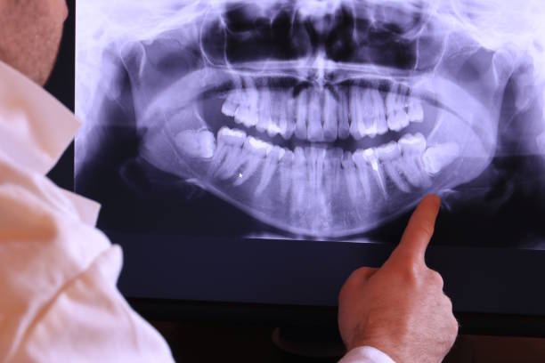 Best Knocked-Out Tooth Emergency  in Dekal, IL