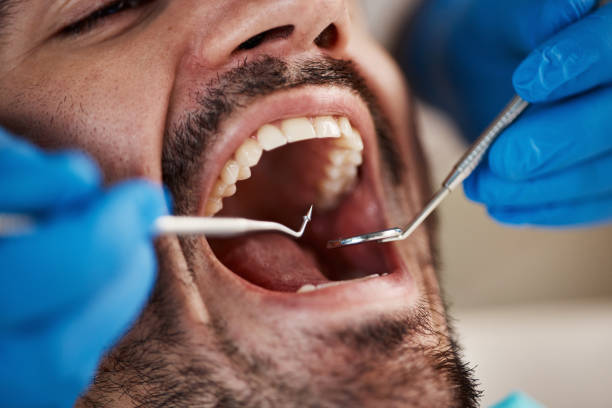 Best Chipped Tooth Repair Near Me  in Dekal, IL